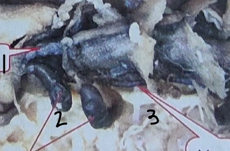 <p>What is point 3 on this earthworm</p>