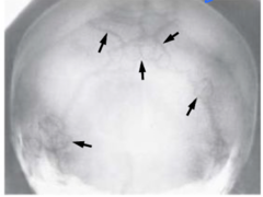 <p>Identify the pathology:</p>