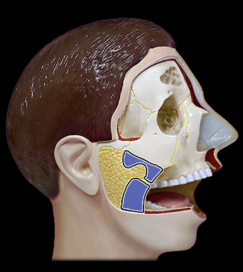 term image
