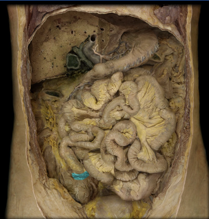 term image
