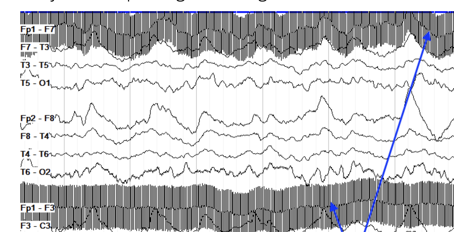 <p>very monotous</p>