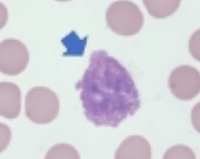 <p>what is it (Staining Blood Smears)</p>