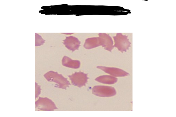 <p>identify the slide</p>