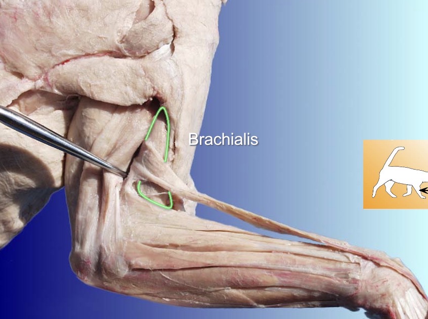 <p>Brachialis</p><p>action: flexes foramen</p><p>s: brachioradialis</p><p>a: triceps brachii (any triceps brachii)</p>