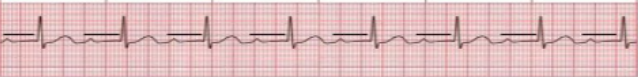 <p>what waveform is this</p>