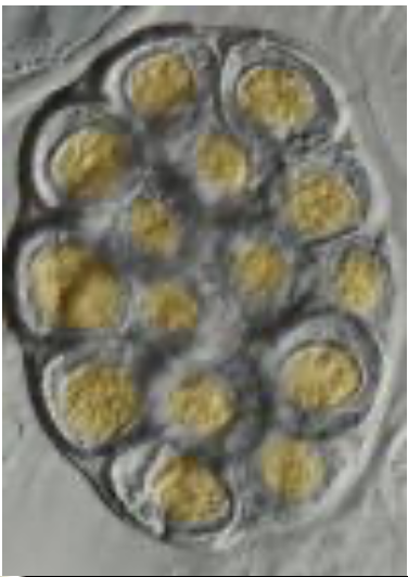 <p>Dipylidium caninum</p>