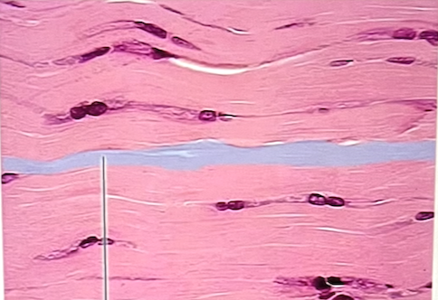 <p>identify the specific connective tissue in the picture</p>