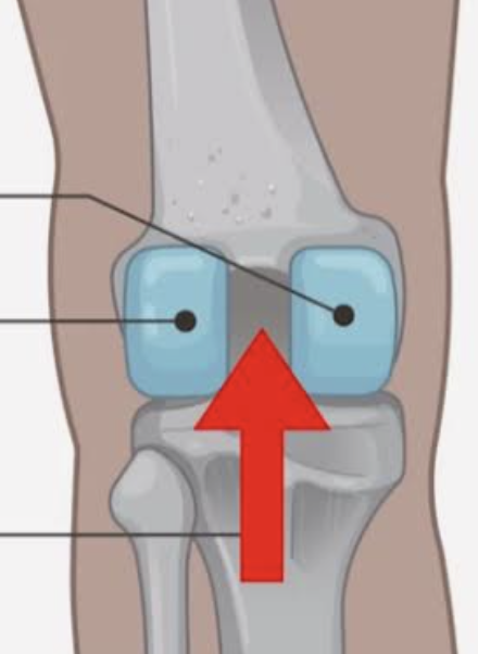 <p>Which bone is this?</p>