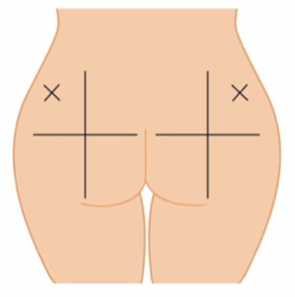 term image