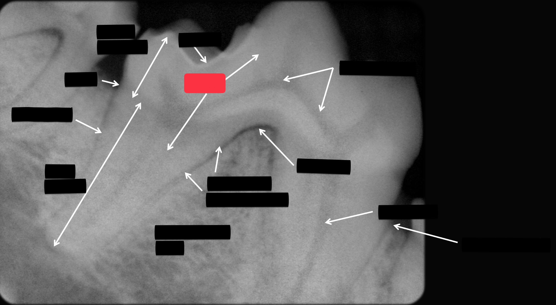 <p>Label this part of the tooth.</p>