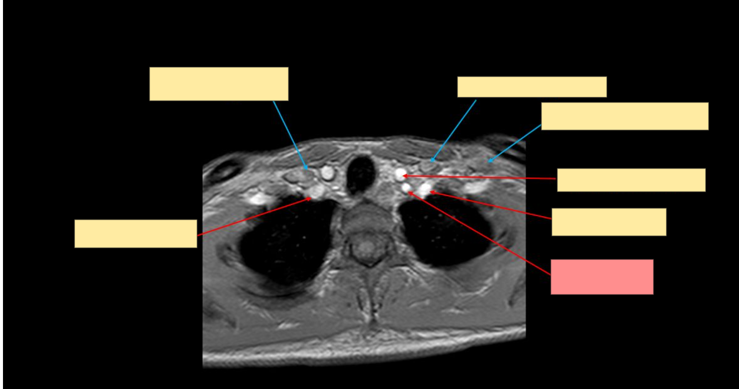 <p>Name the structure</p>