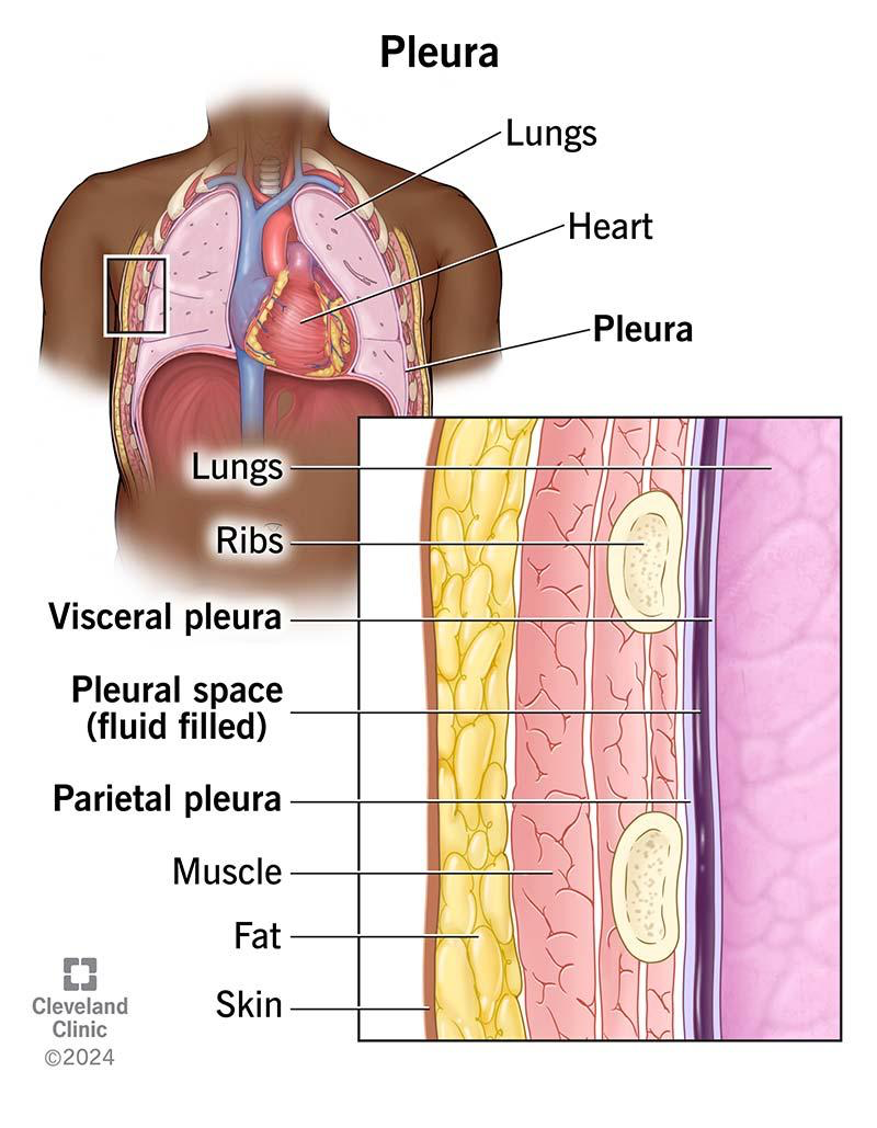 <p>The pleura is a double-layered membrane surrounding the lungs. </p><p>It consists of two layers: </p><p>Visceral pleura and Parietal pleura. </p><p></p>