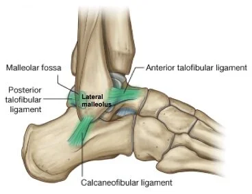 <p><strong>Fibulotalaris anterior FTA</strong></p><p></p><p><strong>Ursprung</strong></p><p>Nedre främre del fibula</p><p></p><p><strong>Fäste</strong></p><p>Övre främre del talis</p><p></p><p><strong>Funktion</strong></p><p>Hindrar foten glida framåt till underbenet</p><p></p><p><strong>Calcaneofibularis CF</strong></p><p></p><p><strong>Ursprung</strong></p><p>Nedre del av fibula</p><p></p><p><strong>Fäste</strong></p><p>Lateralt på calcaneus</p><p></p><p><strong>Funktion</strong></p><p>Hindrar medial tilt av talus-calcaneus på underben</p><p></p><p><strong>Fibulotalaris posterior FTP</strong></p><p></p><p><strong>Ursprung</strong></p><p>Bakre del av fibula</p><p></p><p><strong>Fäste</strong></p><p>Bak på talus</p><p></p><p><strong>Funktion</strong></p><p>Hindrar foten glida bakåt på underbenet</p><p></p><p><strong>Deltoid</strong></p><p></p><p><strong>Ursprung</strong></p><p>Distala tibia (mediala malleolen)</p><p></p><p><strong>Fäste</strong></p><p>Os naviculare</p><p>systemetaculum tali</p><p>Os talus</p><p></p><p><strong>Rörelse</strong></p><p>Motsvarar FTA, CF och FTP men medialt</p>