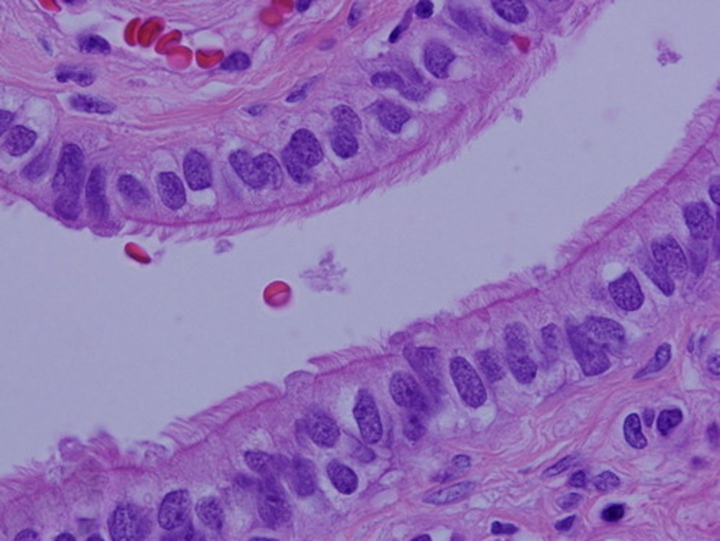 <p>tall rectangular; microvilli to increase surface area for absorption</p><p>(small intestine, gallbladder, kidney tubules)</p>