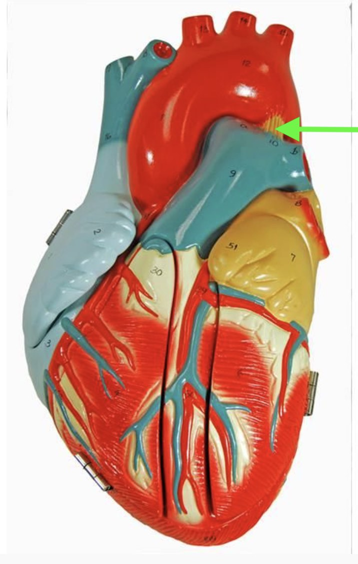 <p><strong>Identify the indicated structure.</strong></p>