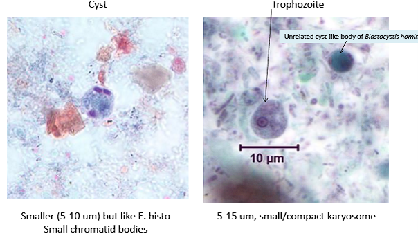 <p>Cyst: small chromatid bodies</p><p>Trophozoite: Small, compact karyosome</p>