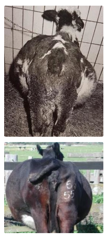 <p><strong>CHRONIC DISEASE</strong></p><ol><li><p>Chronic and non-specific signs: Anorexia, reduced production, loss of BCS, lethargy, rough coat</p></li><li><p>Papple (10-to-4) shape of abdomen due to rumen overload</p><ul><li><p>Apple on left and pear on right due to distension of the right ventral rumen sac too</p></li><li><p>Free gas bloat with NO oesophageal obstruction (check by passing tube)</p></li></ul></li><li><p>Increased frequency but decreased intensity of rumen contractions (inefficient contractions)</p></li><li><p>Bradycardia (<60bpm) due to hypokalaemia caused by anorexia</p></li><li><p>± Absent rumen layers and rare rumen ping</p><ul><li><p><strong>Iceberg effect</strong> = Fibre content form ball creating areas of gas-fluid interface</p></li></ul></li><li><p>Palpable ventral rumen sack on rectal exam</p></li><li><p>Flaccid reticulo-omasal opening on laparotomy</p></li><li><p>NOT painful</p></li><li><p>Normal temperature and RR</p></li><li><p>Scant, sticky faeces with long fibres (not chewing cud)</p></li></ol><p></p>