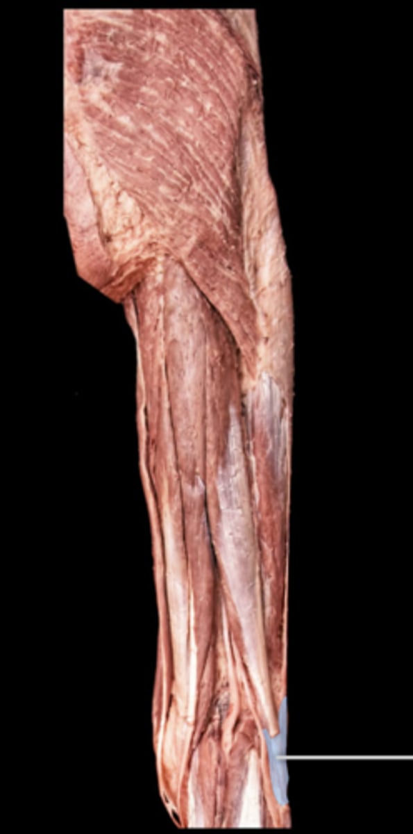 <p>What muscle is this?</p>