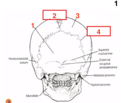 <p>What structure is 3?</p>