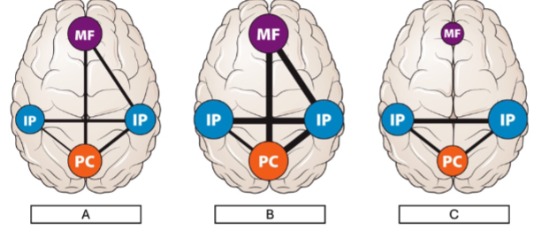 <p>When awake, in light sleep, and in deep sleep, connectivity between brain regions changes via strengthening, weakening, and certain areas going offline. Which of the following connection patterns is indicative of deep sleep?</p>