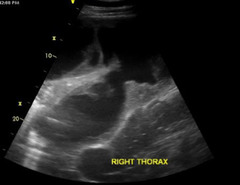 <p>What are you seeing on this equine ultrasound and what is your diagnosis?</p>