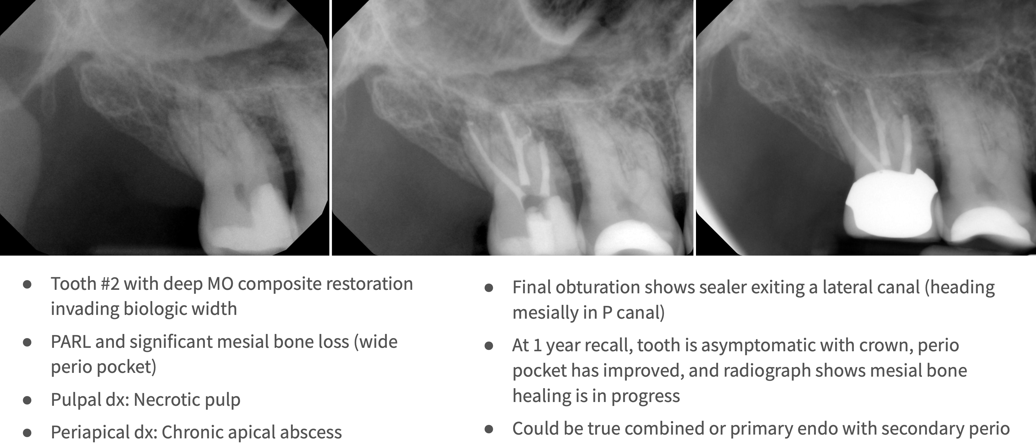 <p>What type of lesion?</p>