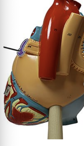 <p>Left Pulmonary Veins </p>