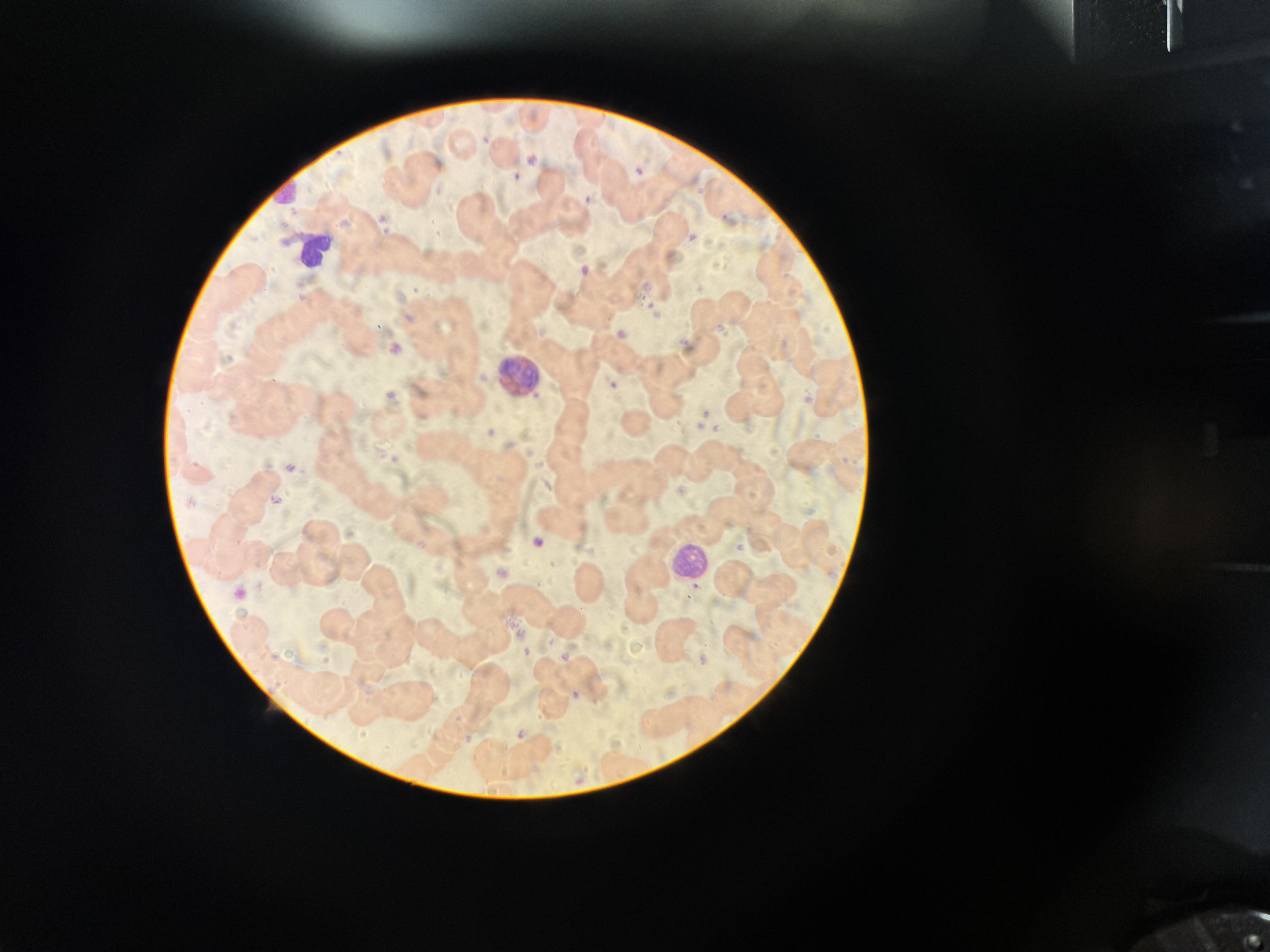 <p>a) Which WBC is this?</p><p>b) Describe the nucleus.</p><p>c) Granule color?</p><p>d) Function?</p>