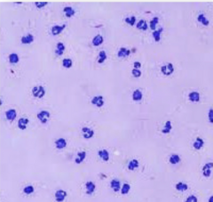 <p>Is this cytology consistent with normal, inflammatory, or noninflammatory joint disease?</p>