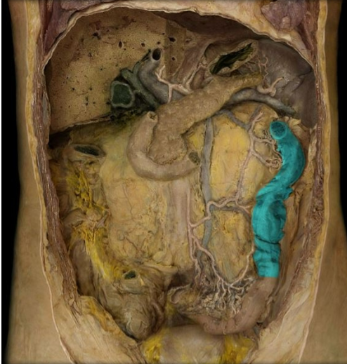 term image