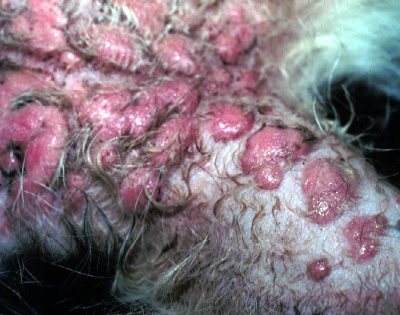<p>Eosinophilic granuloma</p>