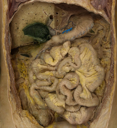 term image