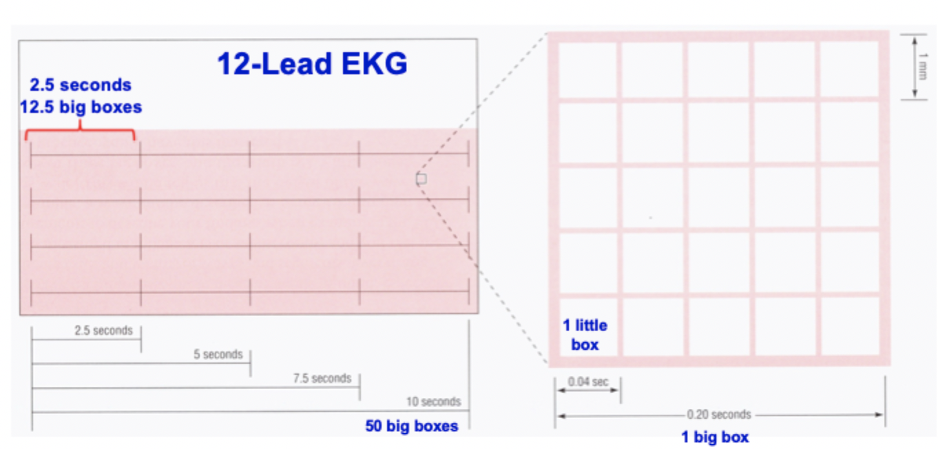 <p>$$50.0\text{ Big Boxes}$$ equaling $$250.0\,mm$$ </p>