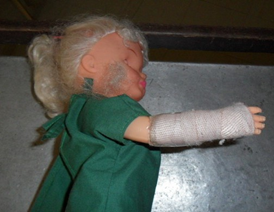 <p>fracture of the wrist and finger with open wound, swelling and infection</p>