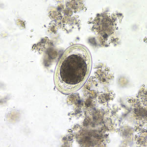<p>Ascaris lumbricoides Life Cycle </p>