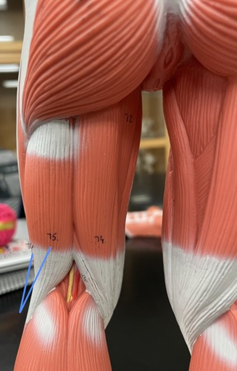 <p>biceps femoris</p><p>origin:</p><p>insertion:</p><p>action:</p>