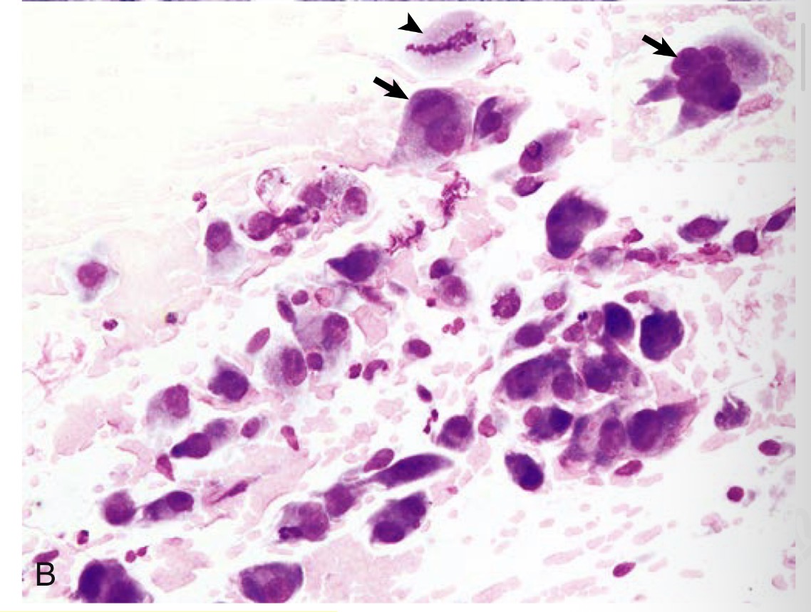 term image