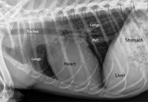 <p>Heart failure classic clinical signs</p>