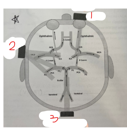 <p>What view is scanned with the transducer at #1?</p>