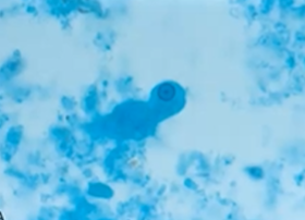 <p><span style="background-color: rgba(0, 0, 0, 0); line-height: 19.7625px;">What is the species seen in this photo and WHY?</span></p>