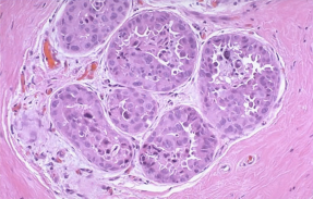 <p>What pathology?</p>