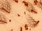 <p>What flagellar arrangment?</p>