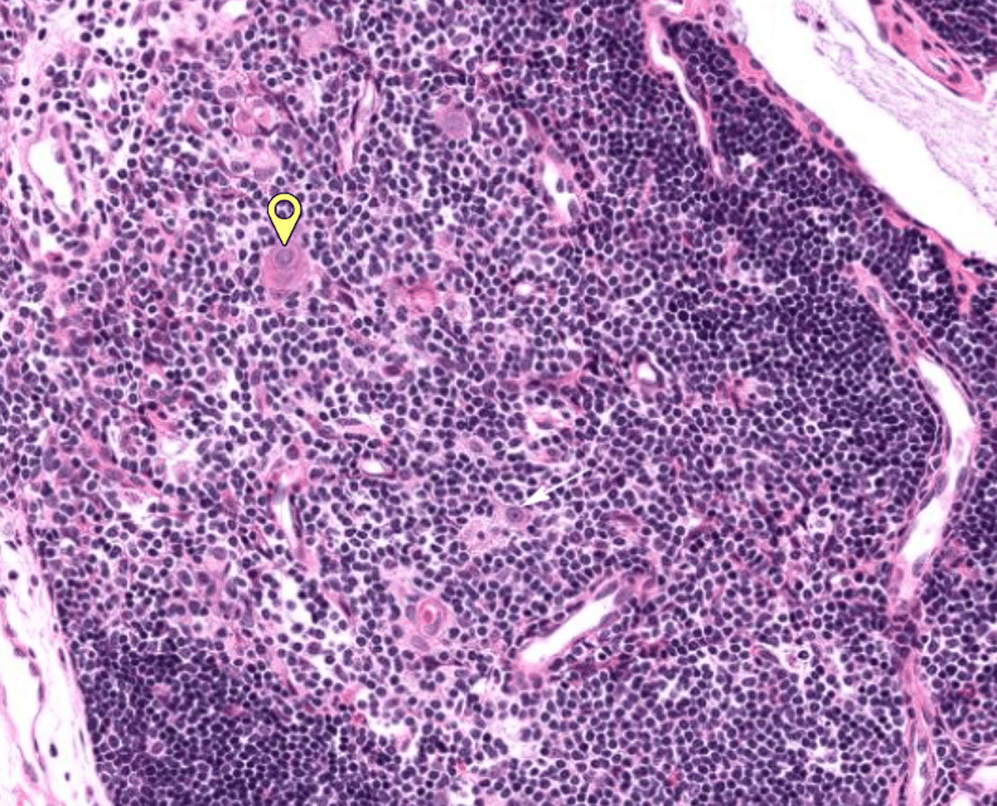<p>What is the yellow icon pointing at (you can find these ONLY in the Thymus)</p>