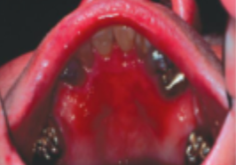 <p>what is this condition</p>