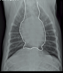 <p>What is being outline here?</p>
