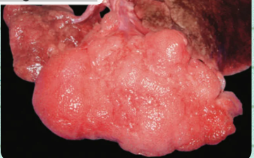 <ul><li><p><span>a congenital dog shows severe distention in the left cranial lobe</span></p></li><li><p><span>The affected lung exhibits notable crepitus upon palpation</span></p></li></ul><p></p>
