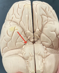 <p>Identify the Number, Name, and Type (sensory, motor, or both)</p>