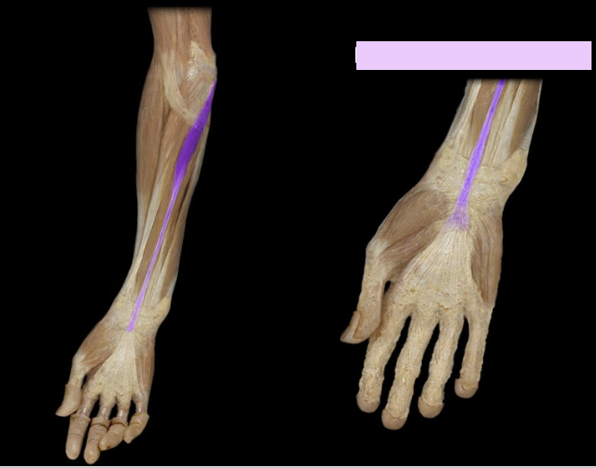 <p>What the highlighted structure is acting on the <strong><mark data-color="#ffdb9c" style="background-color: rgb(255, 219, 156); color: inherit;">Wrist and Hands</mark>.</strong> What muscle is this called?</p>