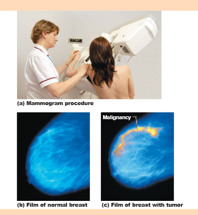 <p>BRCA1 and BRCA2</p>