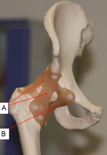 <p>Which of the following is correct about the structures showed in the image?</p><p>Structure A is the ischiofemoral ligament, and structure B is the pubofemoral ligament</p><p>Structure A is the iliofemoral ligament, and structure B is the ischiofemoral ligament</p><p>Structure A is the iliofemoral ligament, and structure B is the pubofemoral ligament</p><p>Structure A is the iliofemoral ligament, and structure B is the transverse acetabular ligament</p>